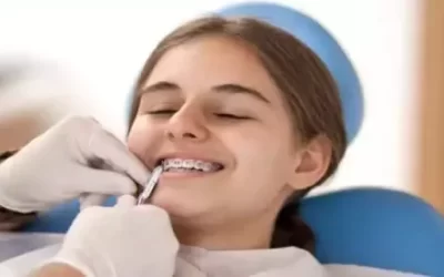 Is extraction really necessary before orthodontic treatment or braces
