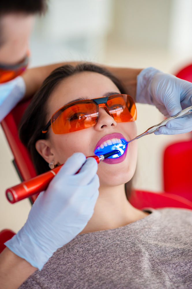 Laser Teeth Whitening