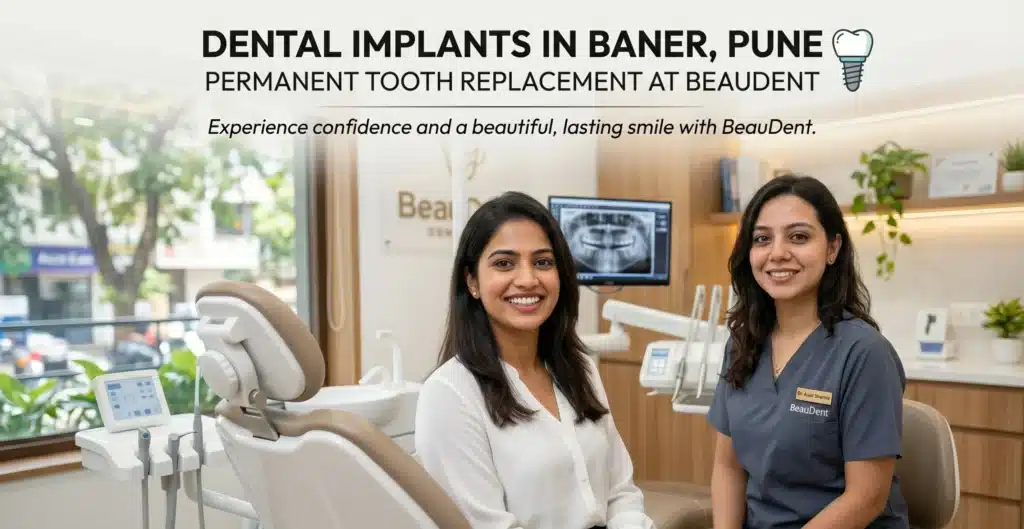 Dental Implants in Baner Pune - Permanent Tooth Replacement at BeauDent
