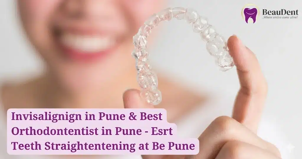 best dentist in baner Invisalign in Baner Pune