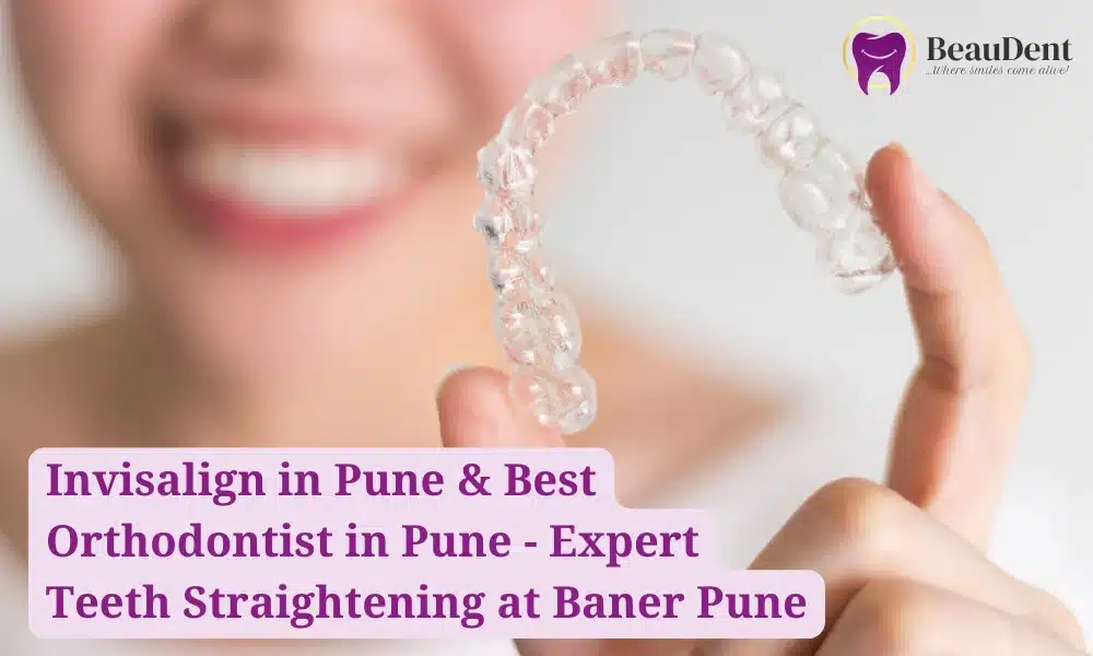 Invisalign in Pune & Best Orthodontist in Pune - Expert Teeth Straightening at Baner Pune
